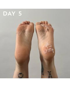 +maskology FOOT PEEL Professional Foot Treatment